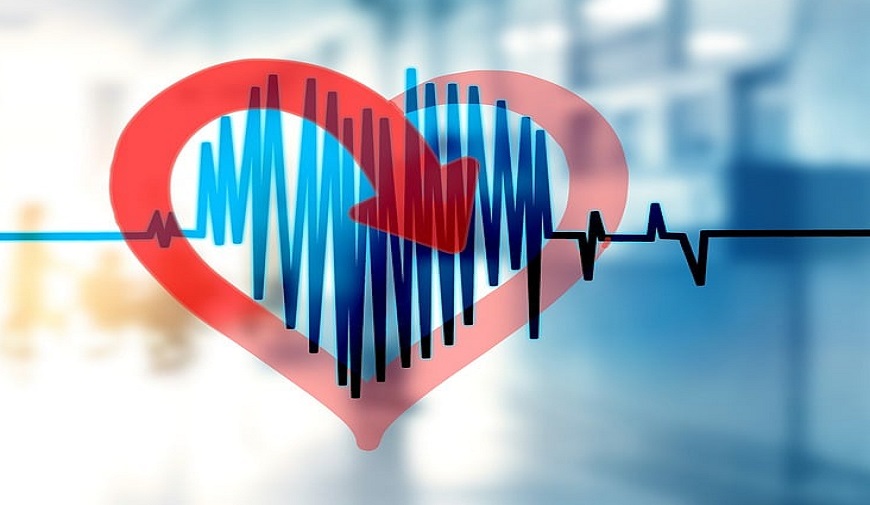 Fibrilación auricular y deterioro cognitivo: una revisión narrativa